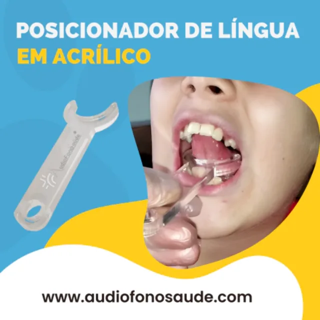 Foto do produto na loja: Posicionador de Língua